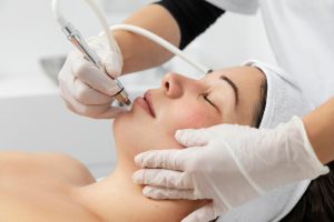 Micro-Needling (Collagen Induction Therapy)