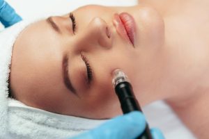 Microdermabrasion with Practical